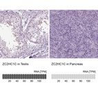 Anti-ZC2HC1C Antibody