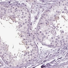 Immunohistochemical staining of human testis shows high expression.