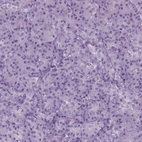 Immunohistochemical staining of human pancreas shows low expression as expected.
