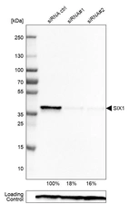 Western blot analysis in Rh30 cells transfected with control siRNA, target specific siRNA probe #1 and #2, using Anti-SIX1 antibody. Remaining relative intensity is presented. Loading control: Anti-PPIB.