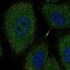 Anti-NTNG2 Antibody