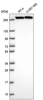Anti-CAD Antibody