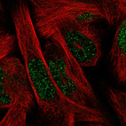 Anti-SIX1 Antibody