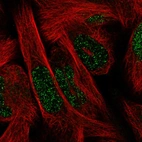 Immunofluorescence staining in RH30 cell line with Anti-SIX1 monoclonal antibody, showing spotty nuclear staining in green. Microtubule probes are visualized in red (where available).