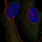 Immunofluorescent staining of human cell line U2OS shows localization to cytosol.