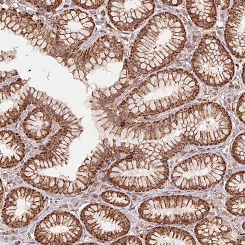 Anti-URM1 Antibody