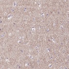 Anti-GRM2 Antibody