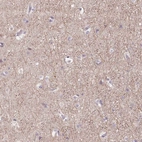 Anti-GRM2 Antibody