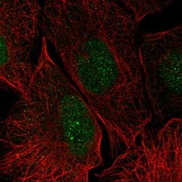 Anti-LGALS14 Antibody