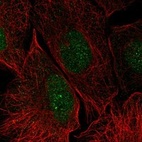 Anti-LGALS14 Antibody
