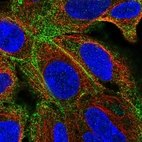 Anti-TMEM50A Antibody