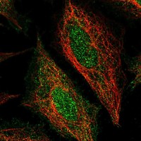 Anti-STEAP4 Antibody