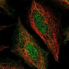 Anti-STEAP4 Antibody