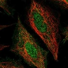 Anti-STEAP4 Antibody