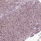 Anti-DDX11 Antibody