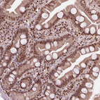 Immunohistochemical staining of human small intestine shows strong nuclear positivity in lymphoid and glandular cells.