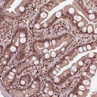 Immunohistochemical staining of human small intestine shows strong nuclear positivity in lymphoid and glandular cells.