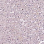 Immunohistochemical staining of human liver shows no positivity in hepatocytes as expected.