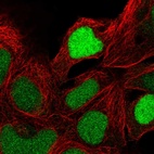 Anti-ZNF444 Antibody