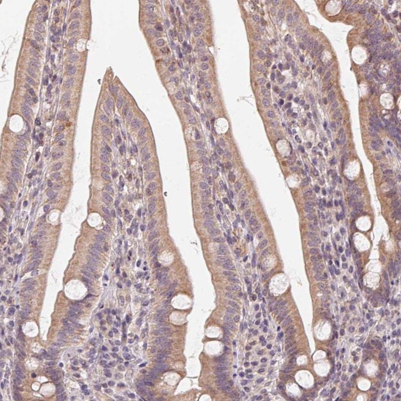 Anti-NCOA4 Antibody