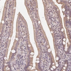 Anti-NCOA4 Antibody