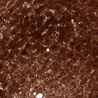 Immunohistochemical staining of human liver shows strong cytoplasmic and nuclear positivity in hepatocytes.