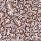 Anti-AMER1 Antibody
