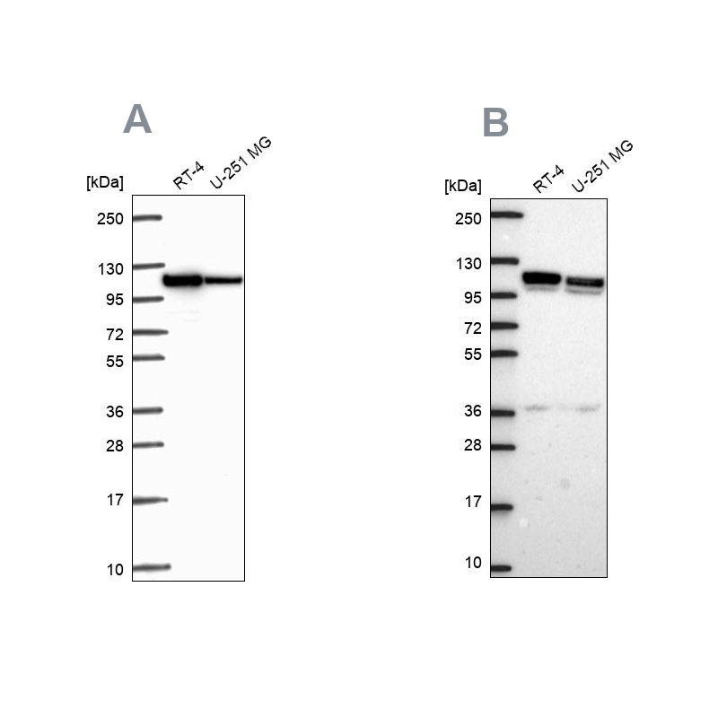 Anti-AP1B1 Antibody