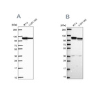 Anti-AP1B1 Antibody