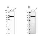 Anti-AP1B1 Antibody