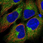 Immunofluorescent staining of human cell line HEK 293 shows localization to cytosol & the Golgi apparatus.