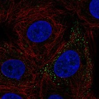 Anti-FERMT3 Antibody
