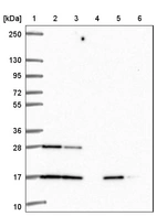 Lane 1: Marker [kDa] 250, 130, 95, 72, 55, 36, 28, 17, 10_br/_Lane 2: Human cell line RT-4_br/_Lane 3: Human cell line U-251 MG_br/_Lane 4: Human plasma_br/_Lane 5: Human Liver tissue_br/_Lane 6: Human Tonsil tissue