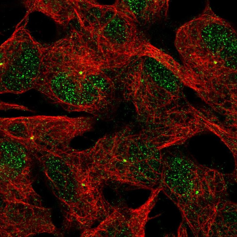 Anti-ACTR8 Antibody