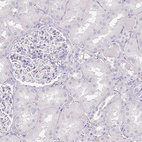 Immunohistochemical staining of human kidney shows no positivity in cells in tubules as expected.
