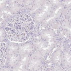 Immunohistochemical staining of human kidney shows no positivity in cells in tubules as expected.