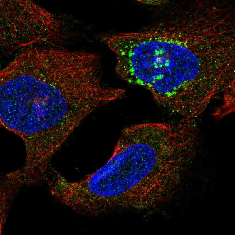 Anti-SLC16A13 Antibody