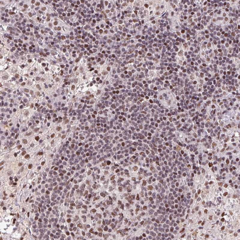 Anti-LDLRAD4 Antibody