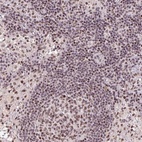 Anti-LDLRAD4 Antibody