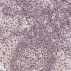 Anti-LDLRAD4 Antibody
