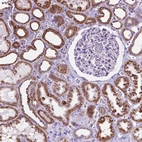 Anti-GDPD5 Antibody