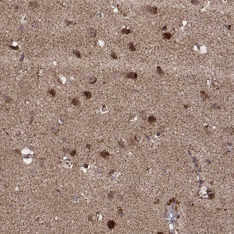 Anti-ZDHHC21 Antibody