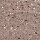 Anti-ZDHHC21 Antibody