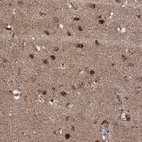 Anti-ZDHHC21 Antibody