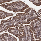 Immunohistochemical staining of human duodenum shows strong cytoplasmic positivity in glandular cells.