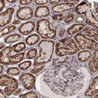 Immunohistochemical staining of human kidney shows strong cytoplasmic positivity in cells in tubules.
