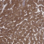 Immunohistochemical staining of human liver shows strong cytoplasmic positivity in hepatocytes.
