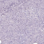 Immunohistochemical staining of human pancreas shows no positivity in exocrine glandular cells as expected.