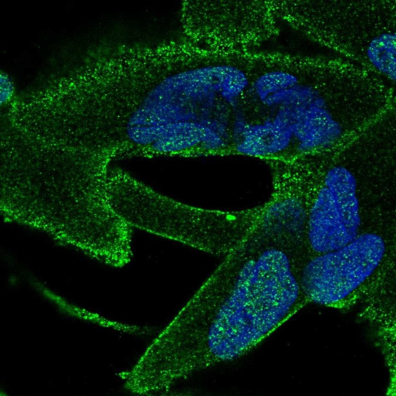 Anti-ANKRA2 Antibody