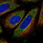 Immunofluorescent staining of human cell line SiHa shows localization to cytosol.